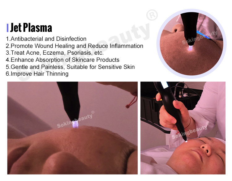 portable cold plasma device for home use