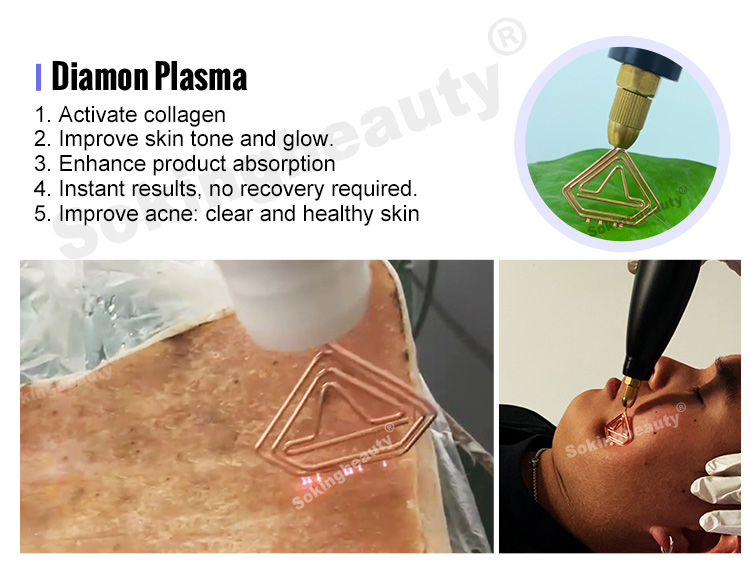 portable cold plasma device for home use
