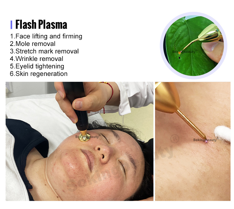 portable cold plasma device for home use