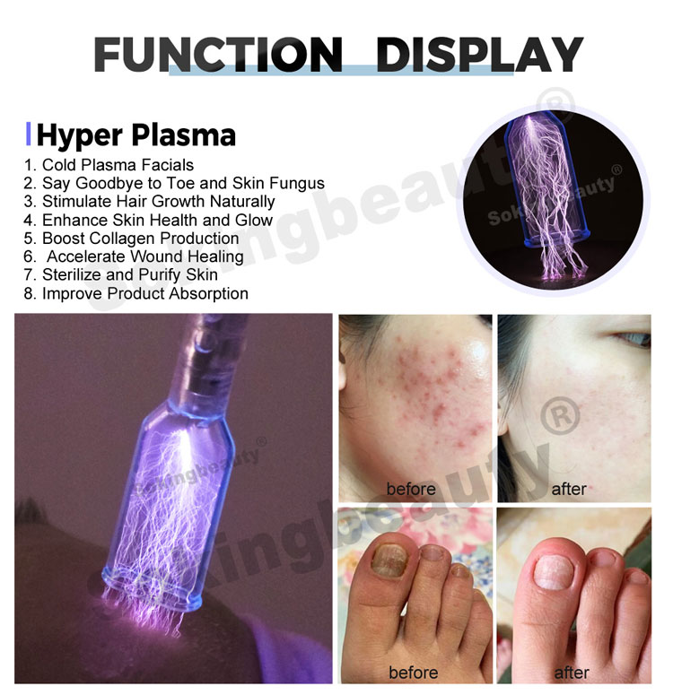 Plasma Lift Pen Machine