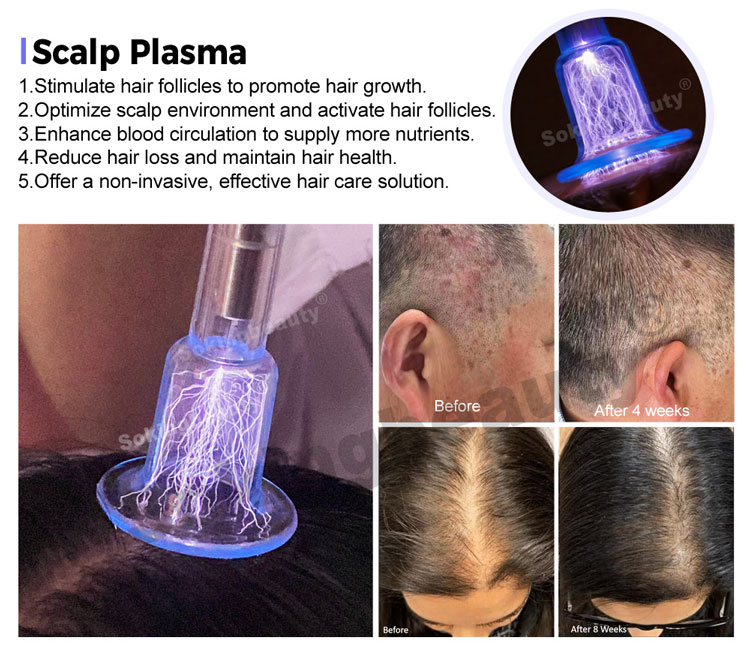 Plasma Lift Pen Machine