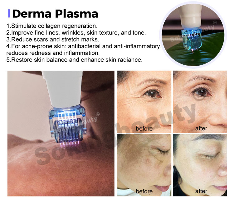 Plasma Lift Pen Machine