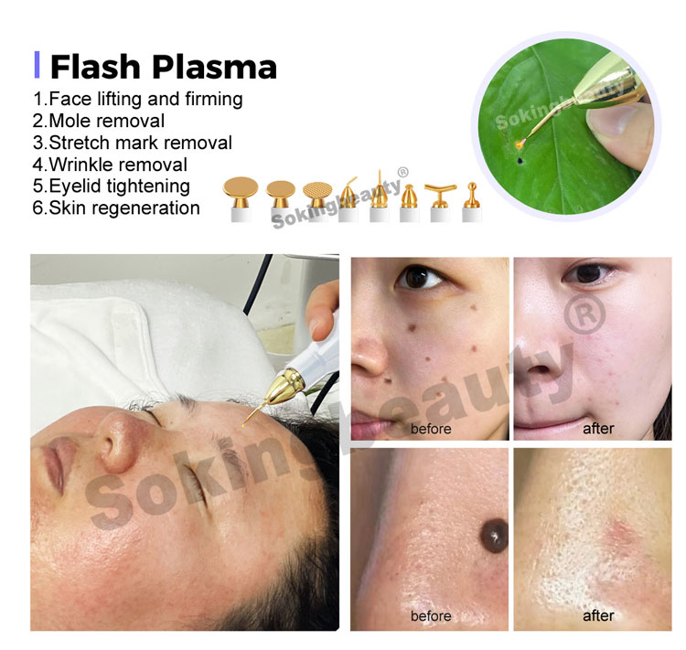 Plasma Lift Pen Machine