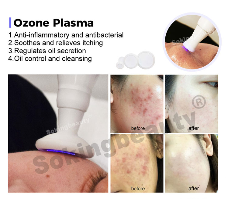 Plasma Lift Pen Machine
