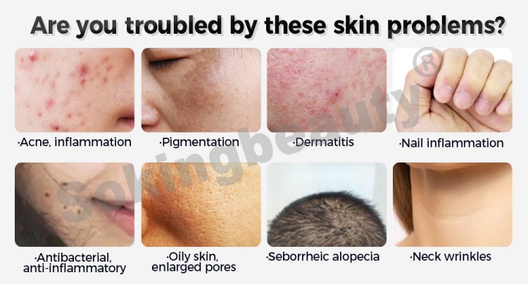 cold plasma medical device03