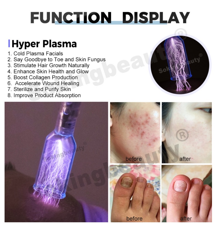 cold plasma medical device04