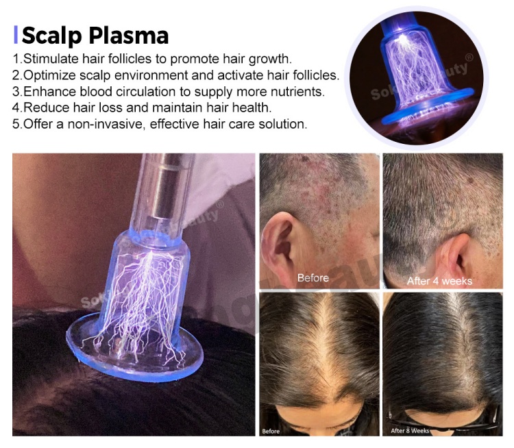 cold plasma medical device05