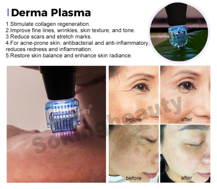 cold plasma medical device06