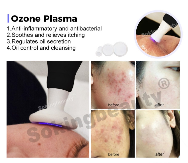 cold plasma medical device12