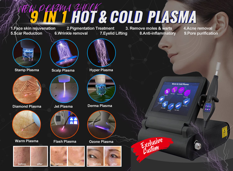 plasma-pen-fibroblast-machine