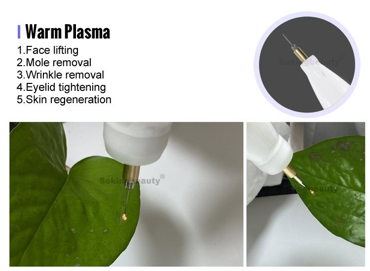 plasma pen fibroblast machine