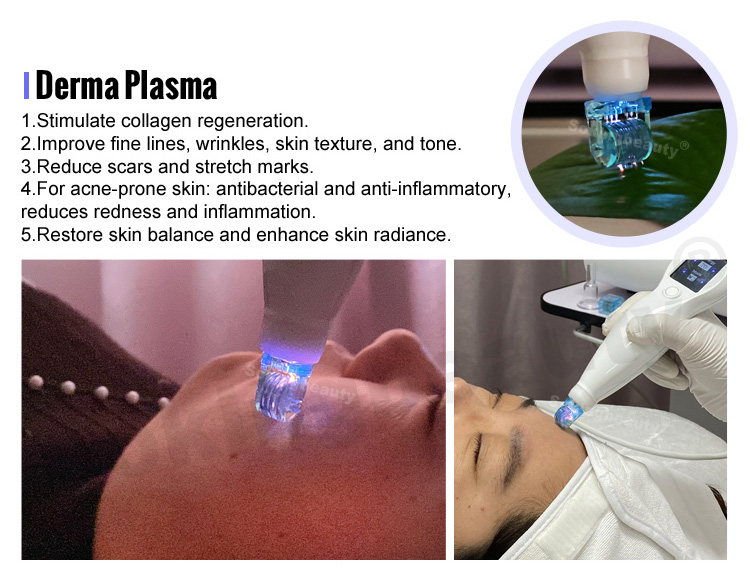 cold plasma machine