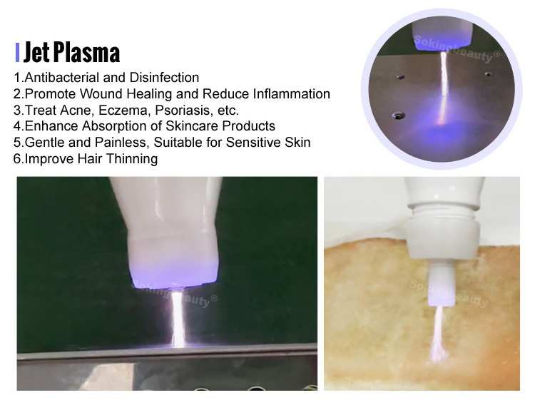 cold plasma machine