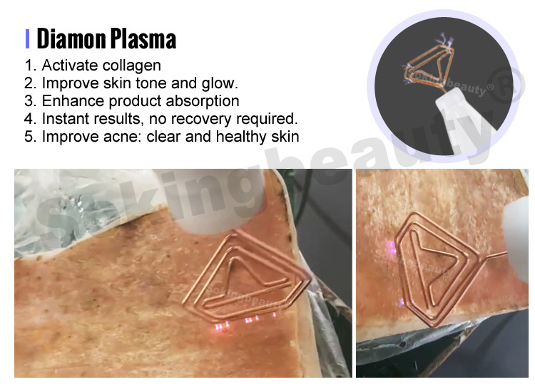 cold plasma machine