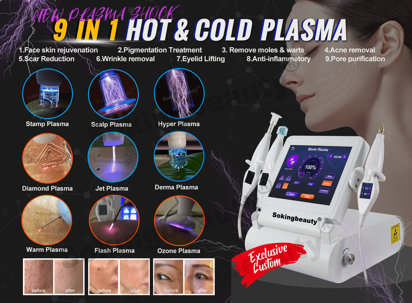 cold-plasma-machine-price-20260416