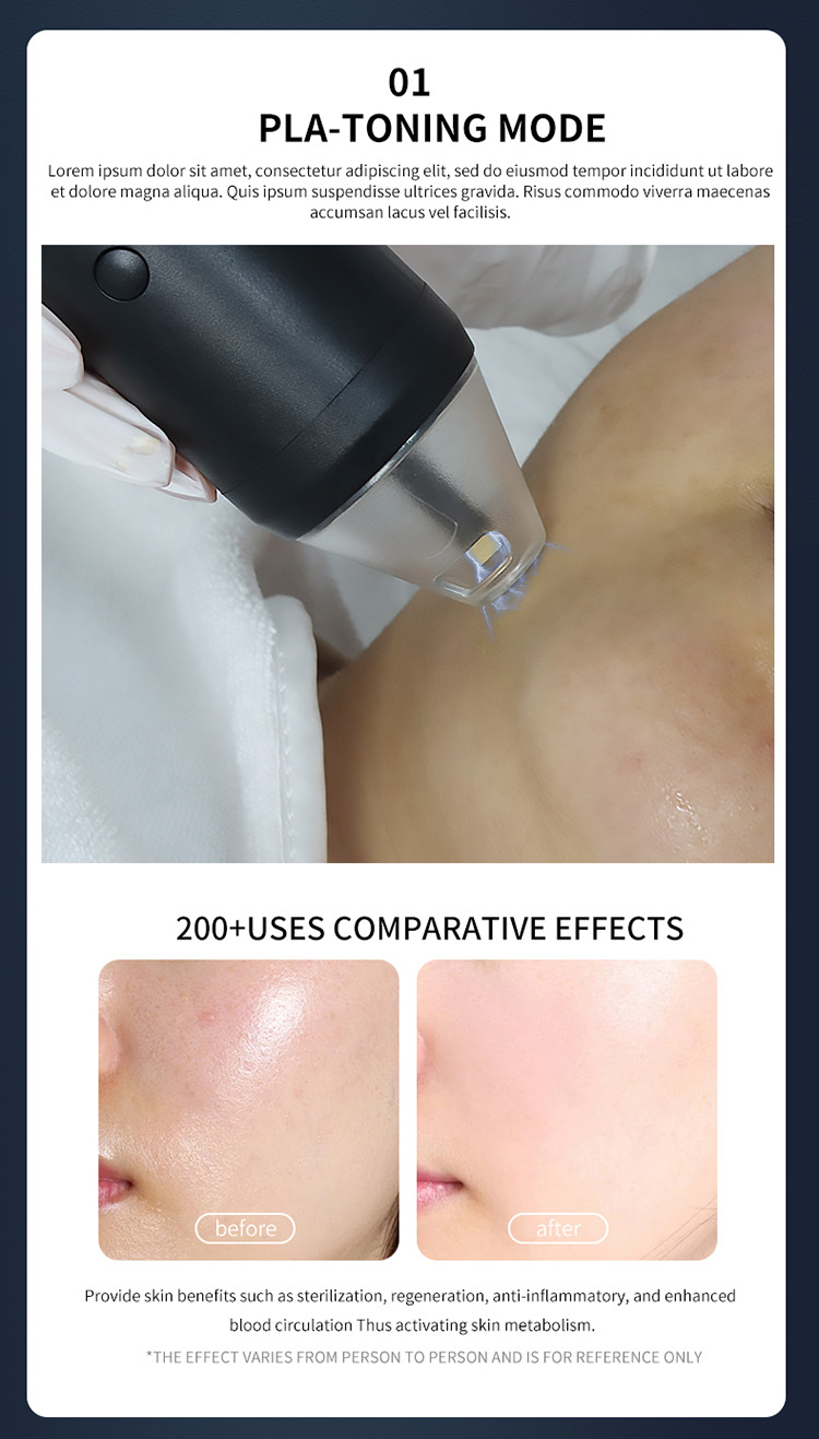 plasma anti aging device08