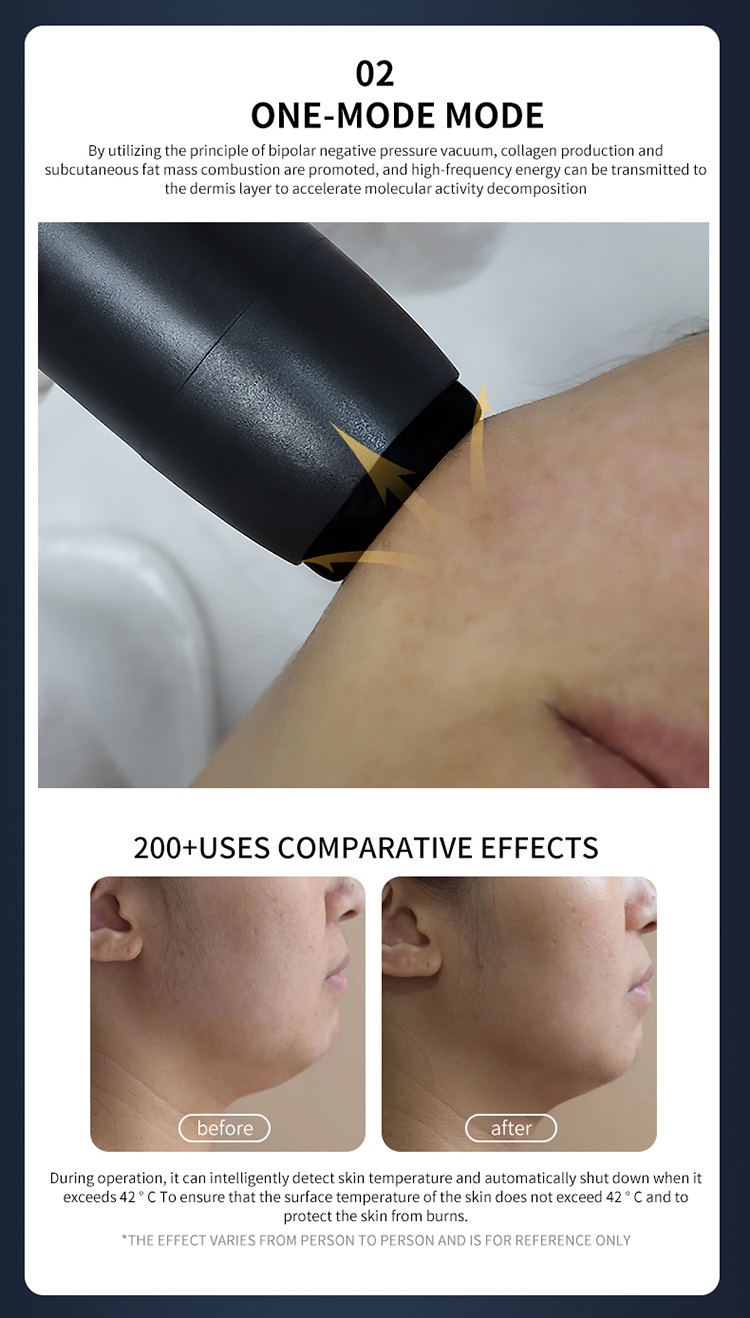 plasma anti aging device09