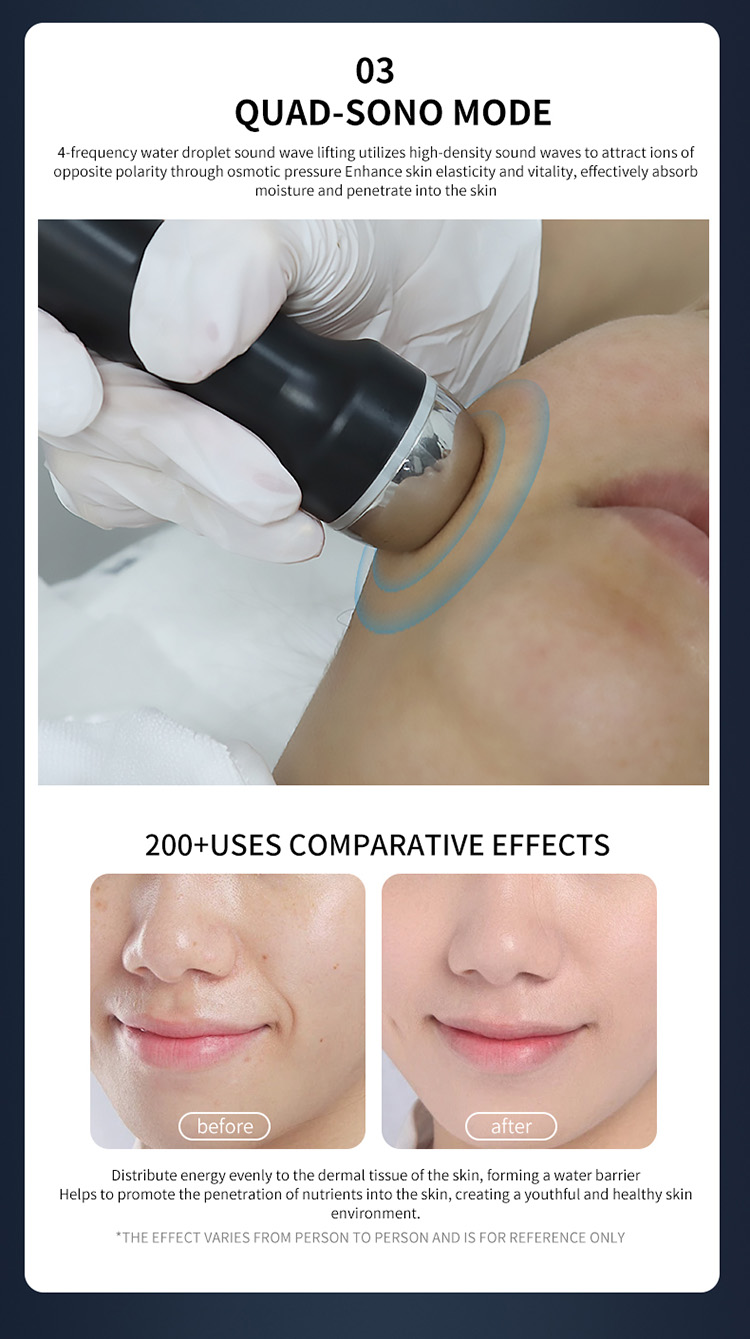 plasma anti aging device10