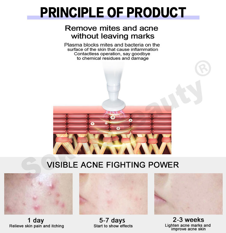 plasma ozone device