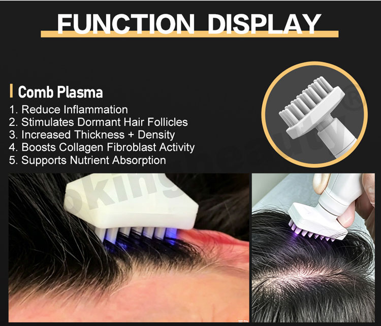 comb tip plasma scalp machine