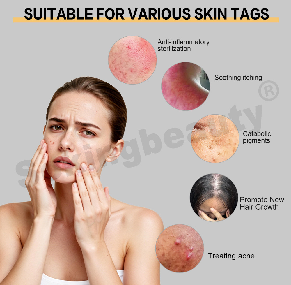 skin-care-ozone-plasma-equipment-09.jpg