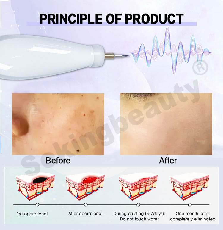 warm plasma facial device