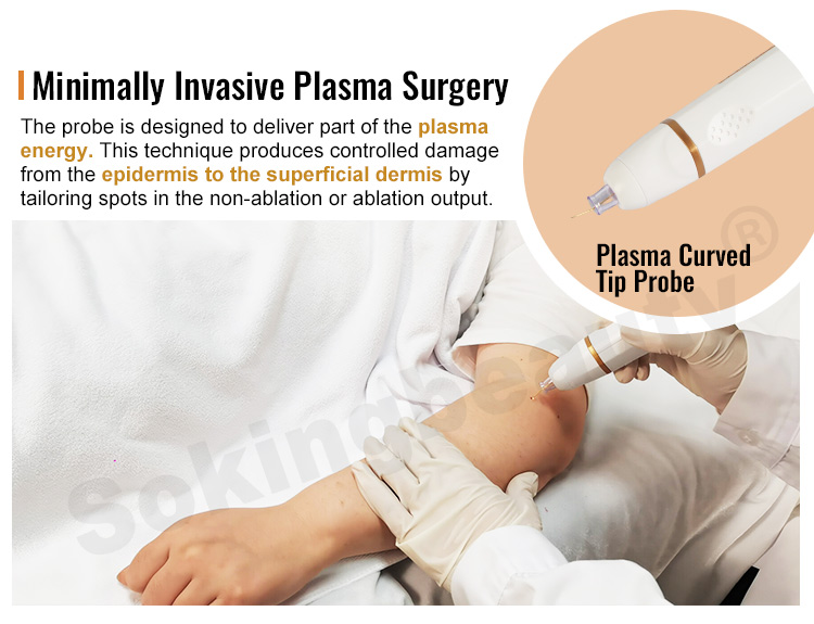 plasma pen skin tightening