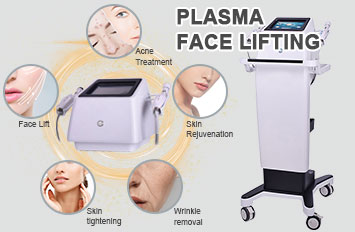 plasma treatment machine